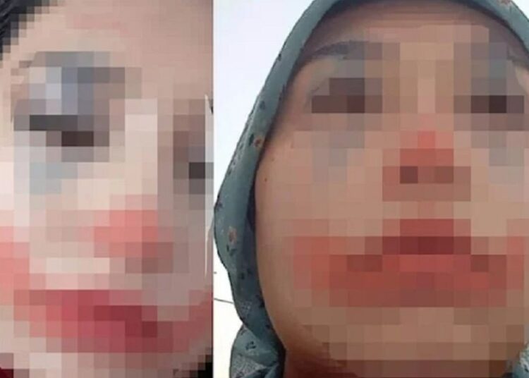 Zorla evlendirildiğini duyuran 15 yaşındaki çocuk korumaya alındı 1 Zorla evlendirildiğini duyuran 15 yaşındaki çocuk korumaya alındı