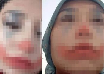 Zorla evlendirildiğini duyuran 15 yaşındaki çocuk korumaya alındı