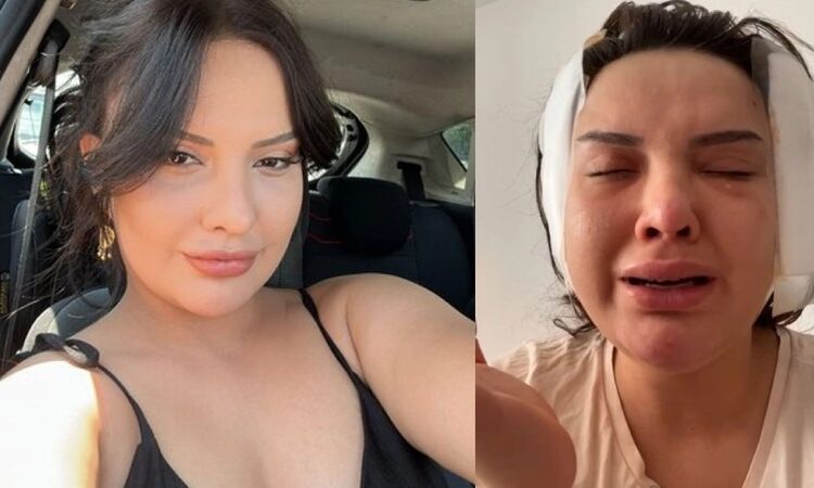 Estetik faciası; badem göz ameliyatı hayatını kararttı 1 Estetik faciası; badem göz ameliyatı hayatını kararttı