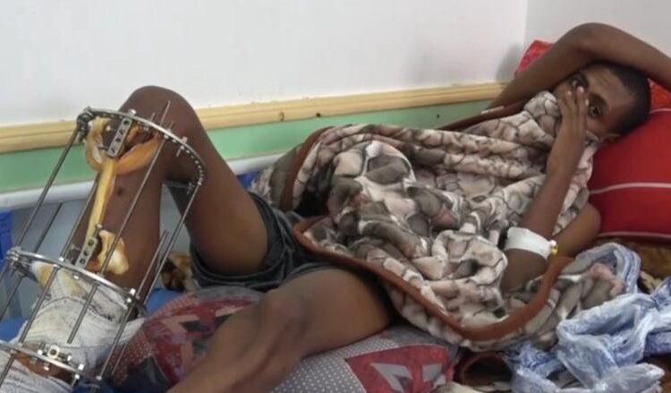 Suudi Arabistan, Yemen sınırında yüzlerce göçmeni öldürmekle suçlanıyor 1 Suudi Arabistan, Yemen sınırında yüzlerce göçmeni öldürmekle suçlanıyor