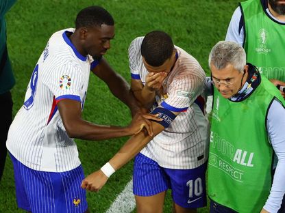 أمم أوروبا: بعد فوزها الافتتاحي على النمسا.. مبابي يصاب بكسر في أنفه 1 أمم أوروبا: بعد فوزها الافتتاحي على النمسا.. مبابي يصاب بكسر في أنفه