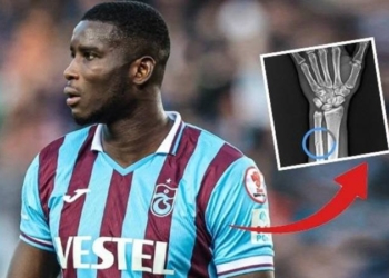 Trabzonspor’dan Onuachu tepkisi: Kırılın kolun röntgen görüntüsü paylaşıldı