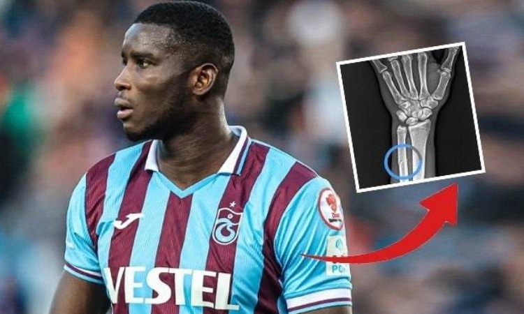 Trabzonspor'dan Onuachu tepkisi: Kırılın kolun röntgen görüntüsü paylaşıldı 1 Trabzonspor’dan Onuachu tepkisi: Kırılın kolun röntgen görüntüsü paylaşıldı