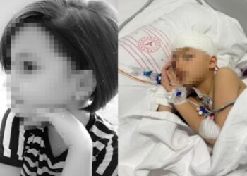 Okulda düştü denildi kafatasında 8 kırık çıktı! Beyin kanaması geçirdi durumu kritik