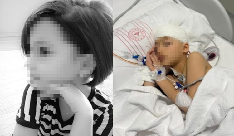 Okulda düştü denildi kafatasında 8 kırık çıktı! Beyin kanaması geçirdi durumu kritik 1 Okulda düştü denildi kafatasında 8 kırık çıktı! Beyin kanaması geçirdi durumu kritik