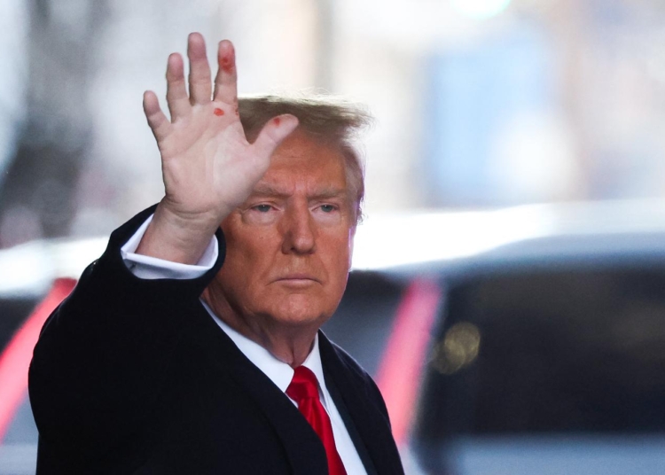 Donald Trump, ellerindeki kırmızı lekeler hakkında nihayet konuştu 1 Donald Trump, ellerindeki kırmızı lekeler hakkında nihayet konuştu