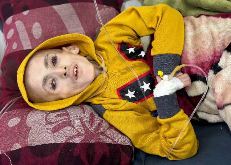 DSÖ'den 'Filistinli çocuklar açlıktan ölüyor' uyarısı 1 DSÖ’den ‘Filistinli çocuklar açlıktan ölüyor’ uyarısı