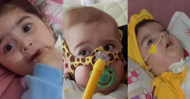 Diyanet: SMA'lı çocuklara zekat, fitre, fidye ödenmemeli 1 Diyanet: SMA’lı çocuklara zekat, fitre, fidye ödenmemeli