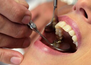 20’lik dişini çektiren kadına hepatit bulaştı