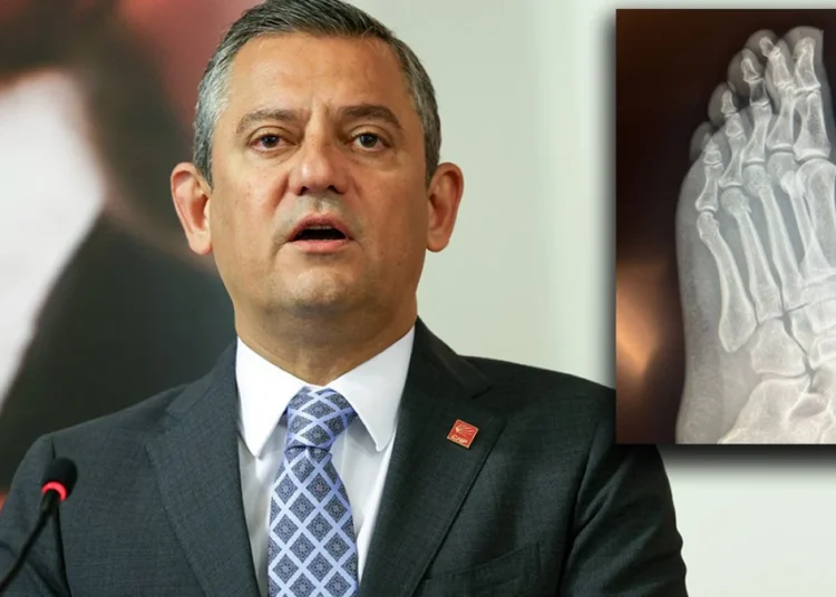 Özel’den ‘ayağından vuruldu’ iddiasına röntgenli cevap