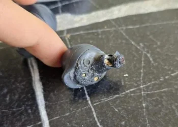 Samsung kulaklık kulağında patlayan genç artık duyamayacak