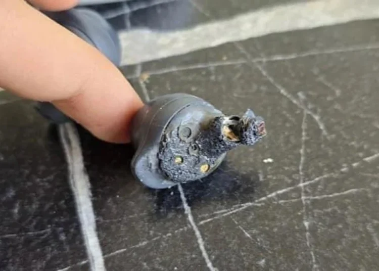 Samsung kulaklık kulağında patlayan genç artık duyamayacak 1 Samsung kulaklık kulağında patlayan genç artık duyamayacak