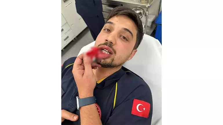 Ambulansın önünü kesip şoförü döven saldırgan tutuklandı 4 Ambulansın önünü kesip şoförü döven saldırgan tutuklandı