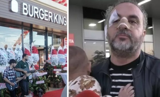 Rize’de Burger King açılışına AK Parti'den destek, protestocuya dayak