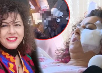 Köpeklerin saldırısına uğrayan akademisyen: Bu artık insan hakları sorunu 5 Köpeklerin saldırısına uğrayan akademisyen: Bu artık insan hakları sorunu