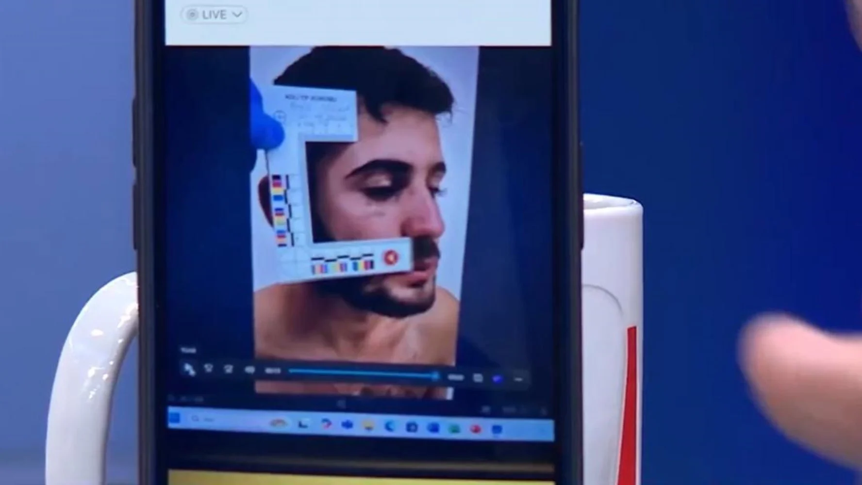 Ağabey Enes Güran'daki ısırık izlerinin fotoğrafları ortaya çıktı!