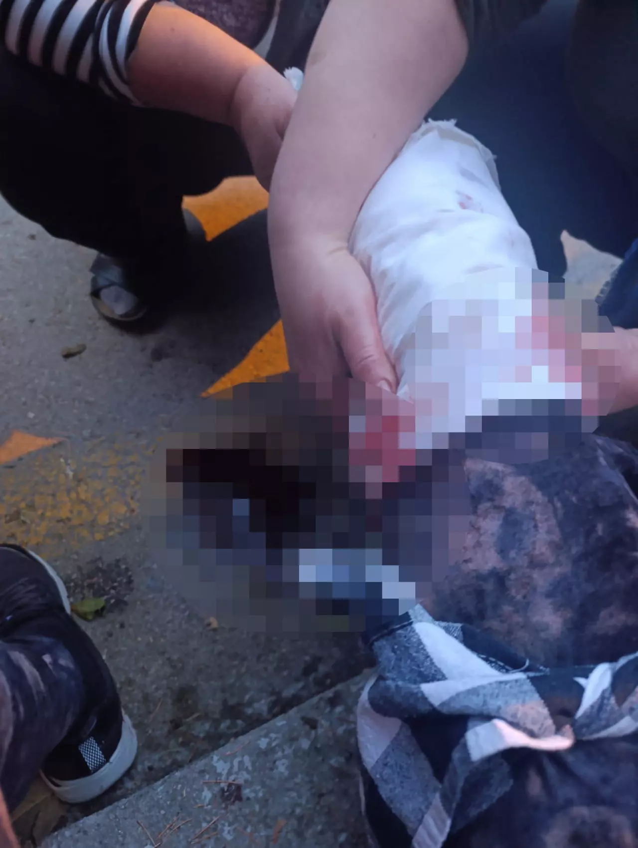 Sokak köpeklerinin saldırdığı kadın profesörün bacakları parçalandı 3 Sokak köpeklerinin saldırdığı kadın profesörün bacakları parçalandı