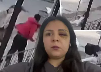 Yolda tanımadığı kişinin saldırısına uğrayan kadın: Sağ gözüme perde indi, sol gözümden kanlar aktı