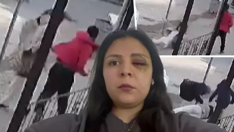Yolda tanımadığı kişinin saldırısına uğrayan kadın: Sağ gözüme perde indi, sol gözümden kanlar aktı 1 Yolda tanımadığı kişinin saldırısına uğrayan kadın: Sağ gözüme perde indi, sol gözümden kanlar aktı