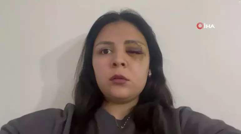 Yolda tanımadığı kişinin saldırısına uğrayan kadın: Sağ gözüme perde indi, sol gözümden kanlar aktı