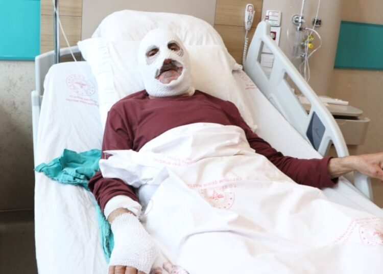 Gaz kaçağını çakmakla kontrol etti, hastanelik oldu 1 Gaz kaçağını çakmakla kontrol etti, hastanelik oldu