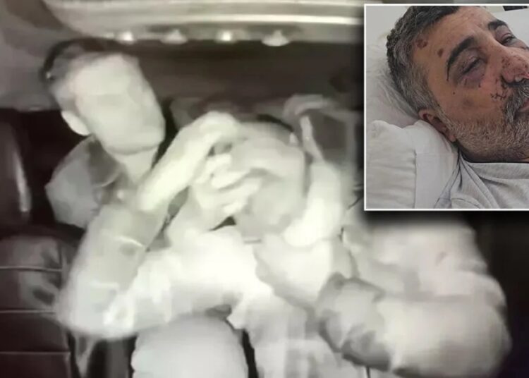 İngiliz boksörün darbettiği taksici: Sebepsiz saldırdı, ısırdı, elini gözüme soktu 1 İngiliz boksörün darbettiği taksici: Sebepsiz saldırdı, ısırdı, elini gözüme soktu