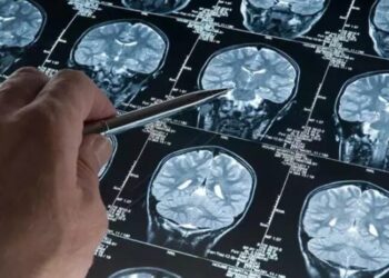 Alzheimer hastalığı artık erken tespit edilebilecek