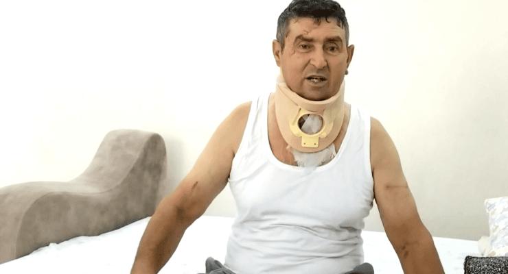 Manavgat'ta aslanın saldırdığı vatandaş: Sadece benim ve aslanın suçu yok 1 Manavgat’ta aslanın saldırdığı vatandaş: Sadece benim ve aslanın suçu yok