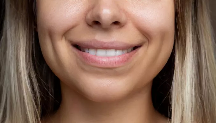 Yeni estetik çılgınlığı hızla yayılıyor: 'Gamzeplasti' 1 Yeni estetik çılgınlığı hızla yayılıyor: ‘Gamzeplasti’