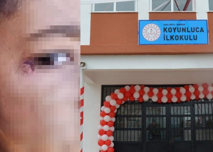 Çocuğun yüzünde sigara söndüren temizlik görevlisi tutuklandı 1 Çocuğun yüzünde sigara söndüren temizlik görevlisi tutuklandı