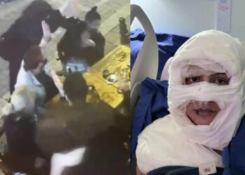 Yanıcı madde dökülüp yakılan kadın bıçaklatılmakla tehdit edildi