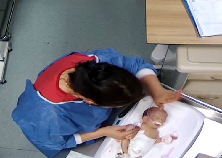 Aynı hemşire bir başka bebeğe daha şiddet uygulamış 1 Hemşirenin darp ettiği 5 günlük bebek engelli hale geldi