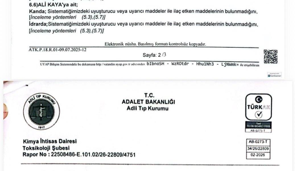 Ali Kaya’nın uyuşturucu test sonucu negatif 2 Ali Kaya’nın uyuşturucu test sonucu negatif