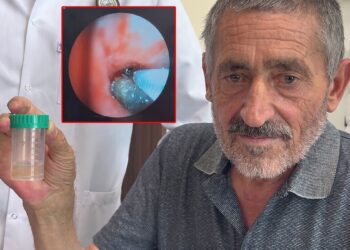 Soluk borusundan çıkan doktorları bile şaşkına çevirdi