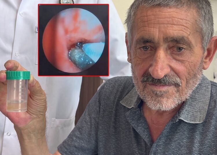 Soluk borusundan çıkan doktorları bile şaşkına çevirdi 1 Soluk borusundan çıkan doktorları bile şaşkına çevirdi